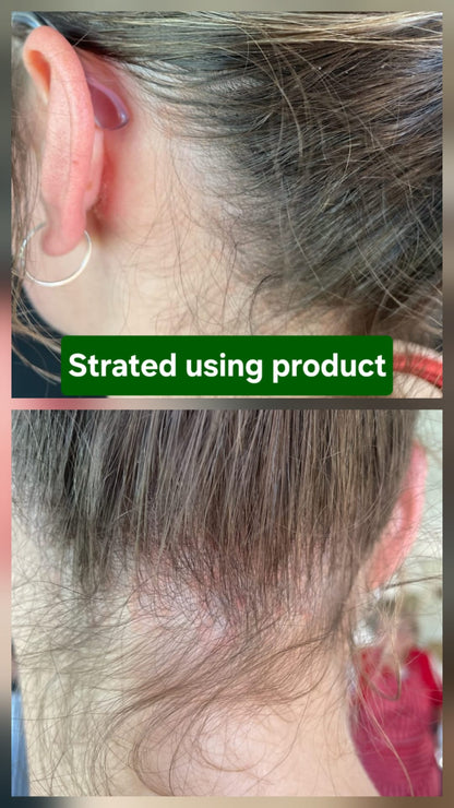 Genesis Comfort Care System - Sensitive Scalp Support