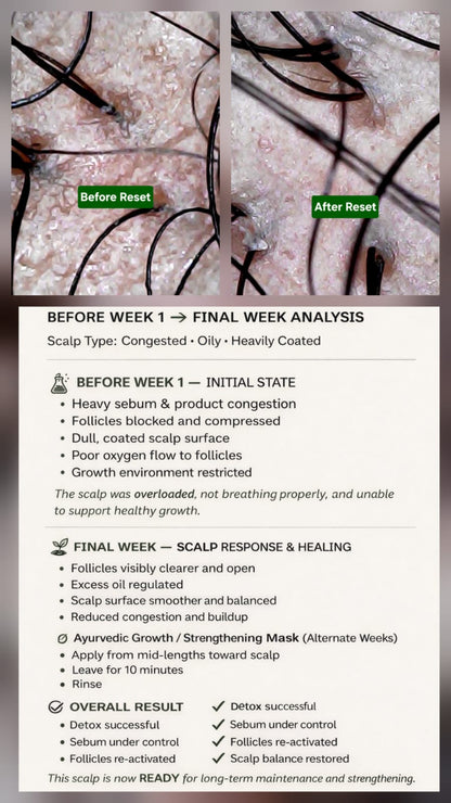 Genesis Scalp Reset System (Phase 1) - Best for Detox